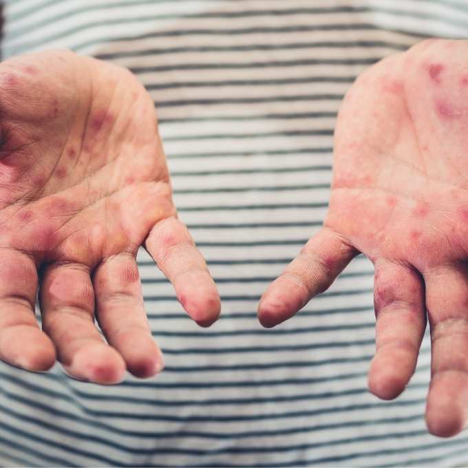 Infectious Disease Cleanup In Iowa	Near Me Infectious Disease Cleanup In Iowa	Near Me